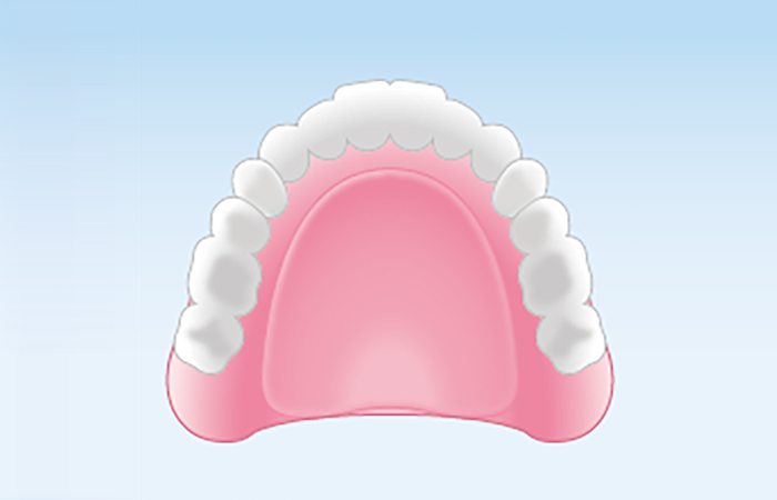 レジン床義歯（保険診療) 